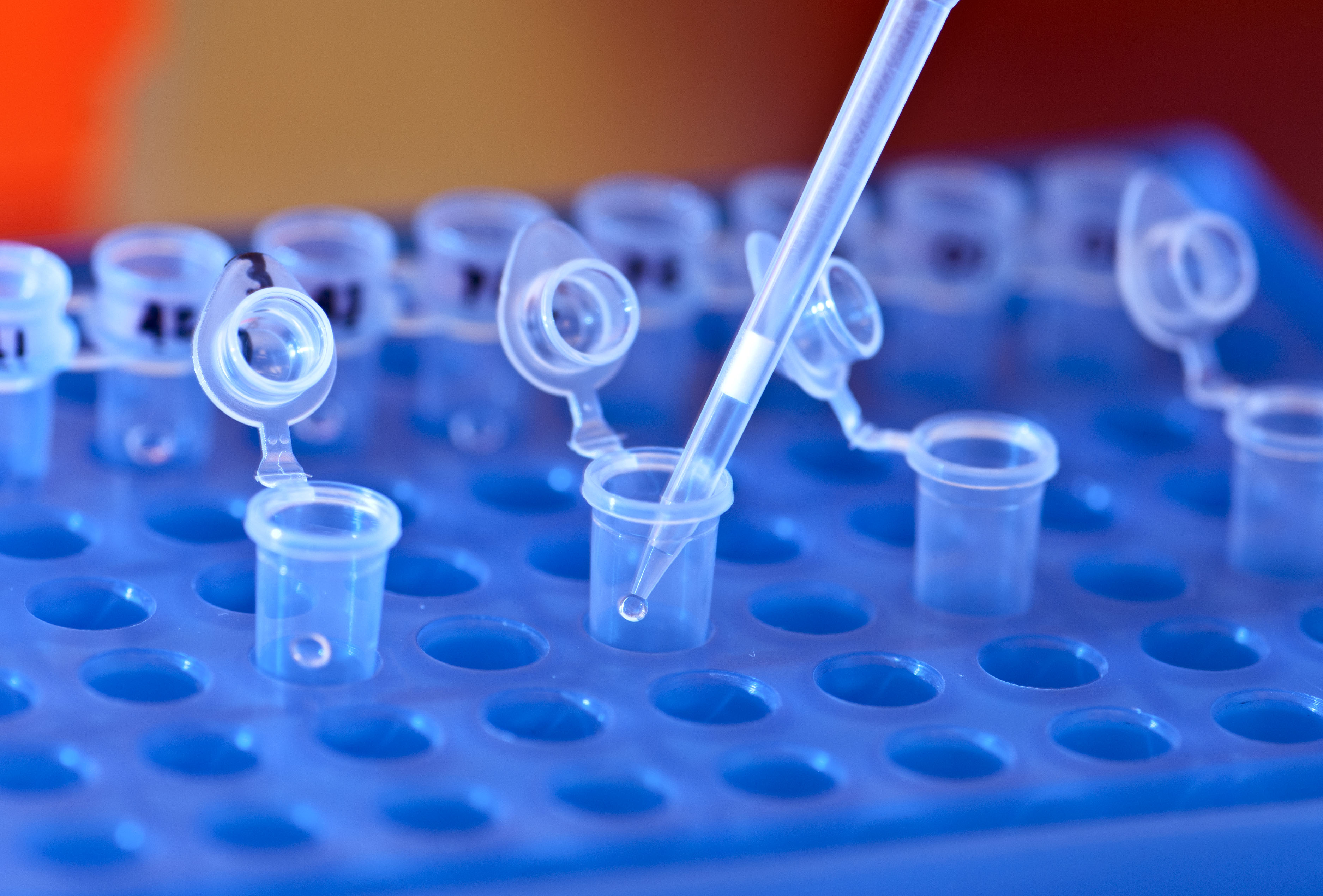 Analyses en laboratoire